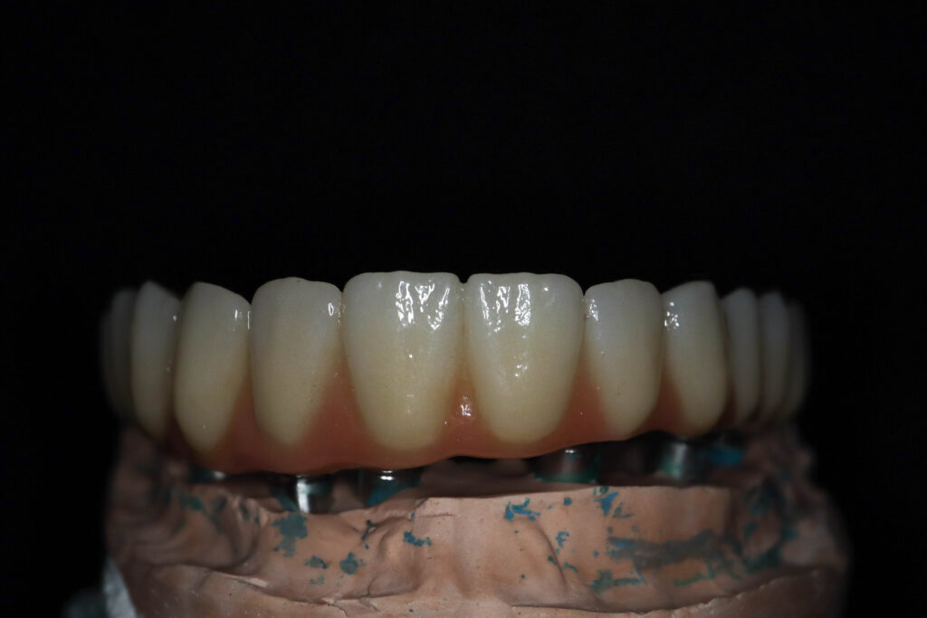 Процесс имплантации Бобков