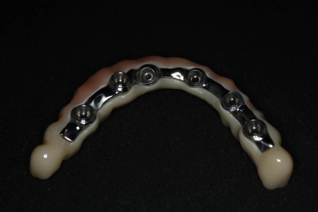 Процесс имплантации Бобков