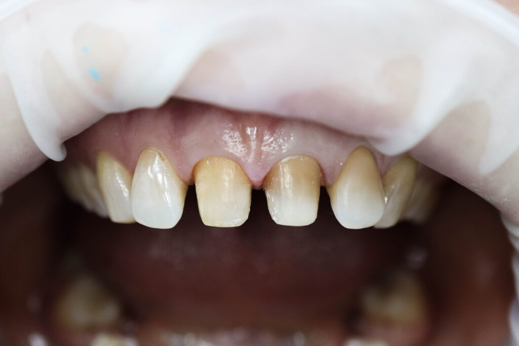 Ситуация до лечения Костюкович