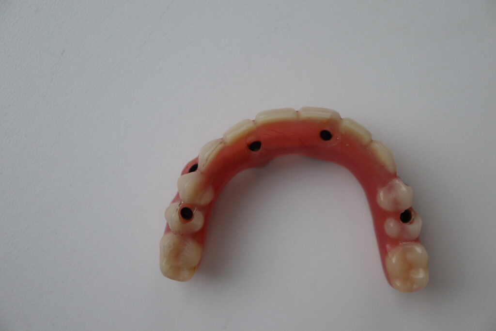 процесс имплантации