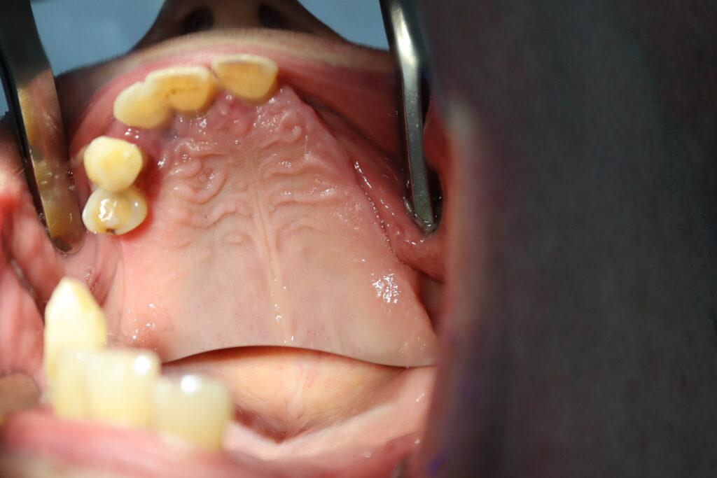 Ситуация до лечения