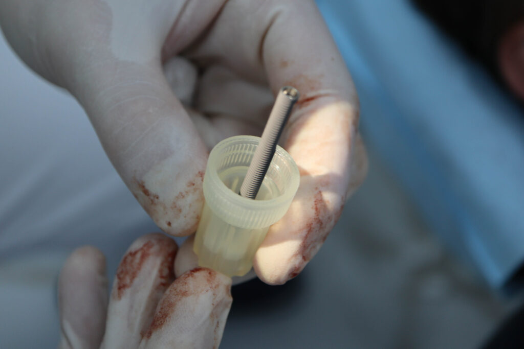 процесс имплантации