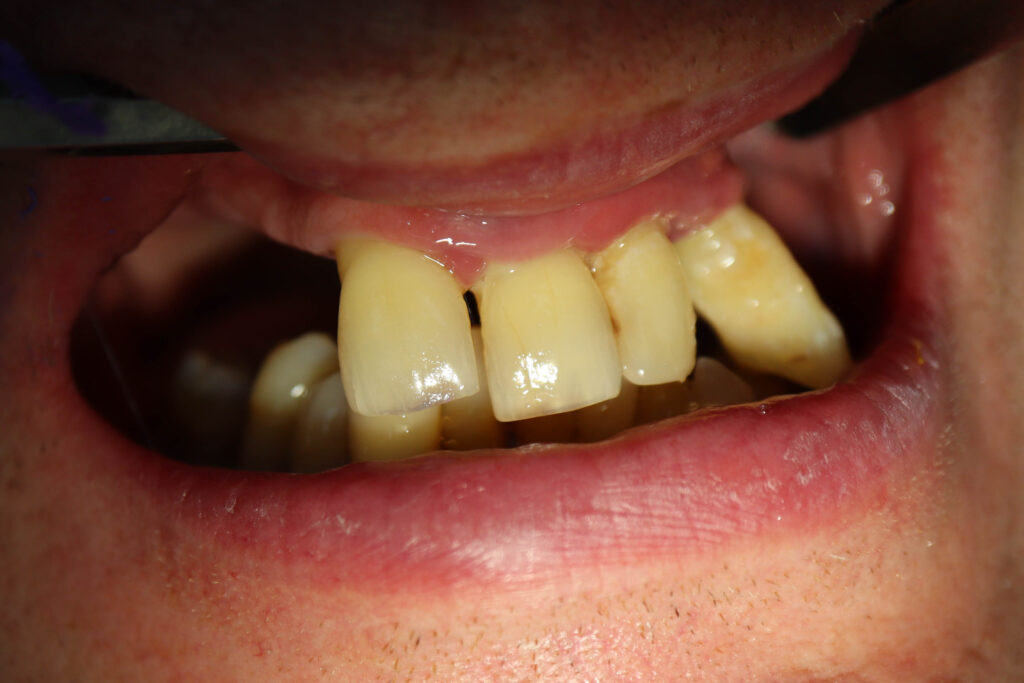 Ситуация до лечения