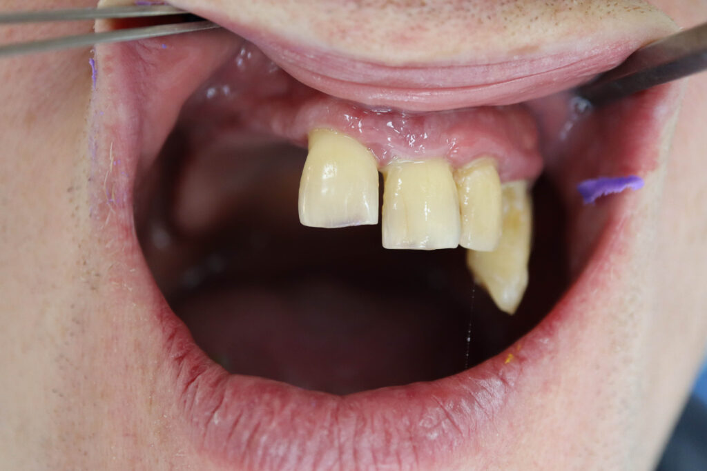 Ситуация до лечения