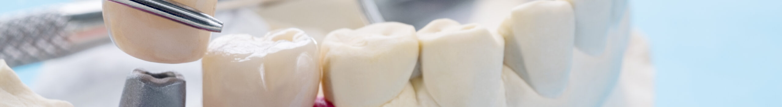 Как проводят процедуру