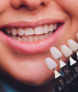 Композитные виниры