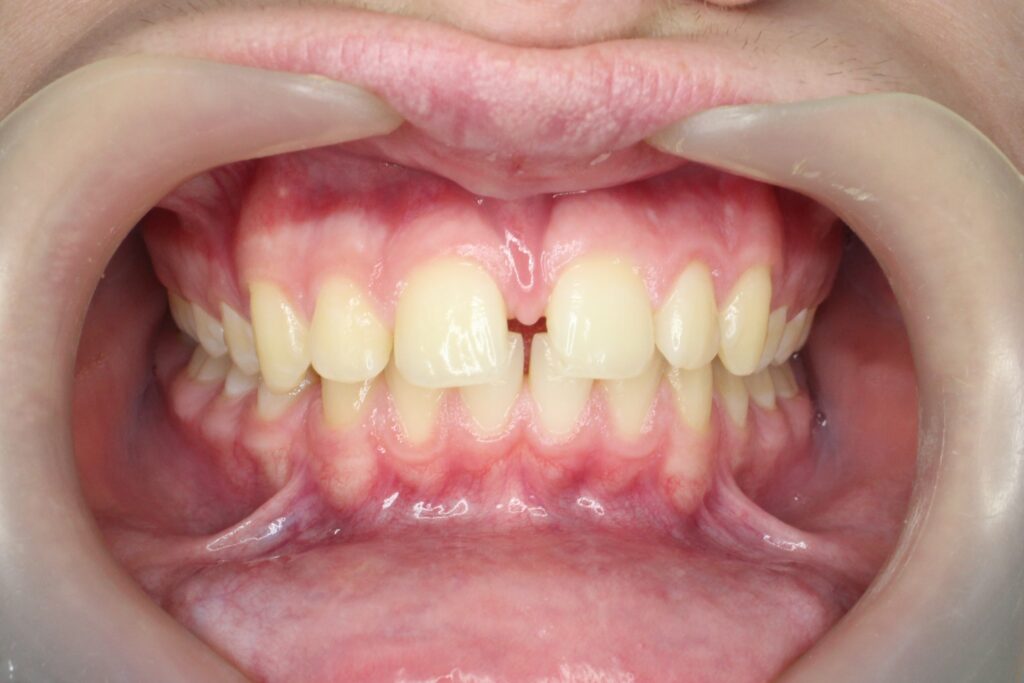 пациент до лечения