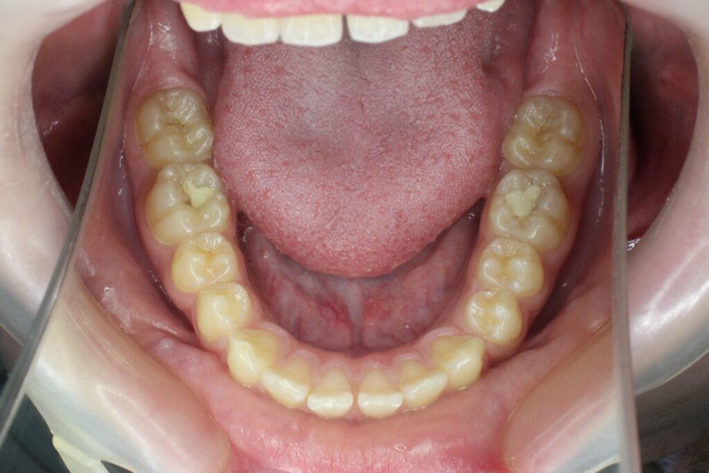 пациент до лечения