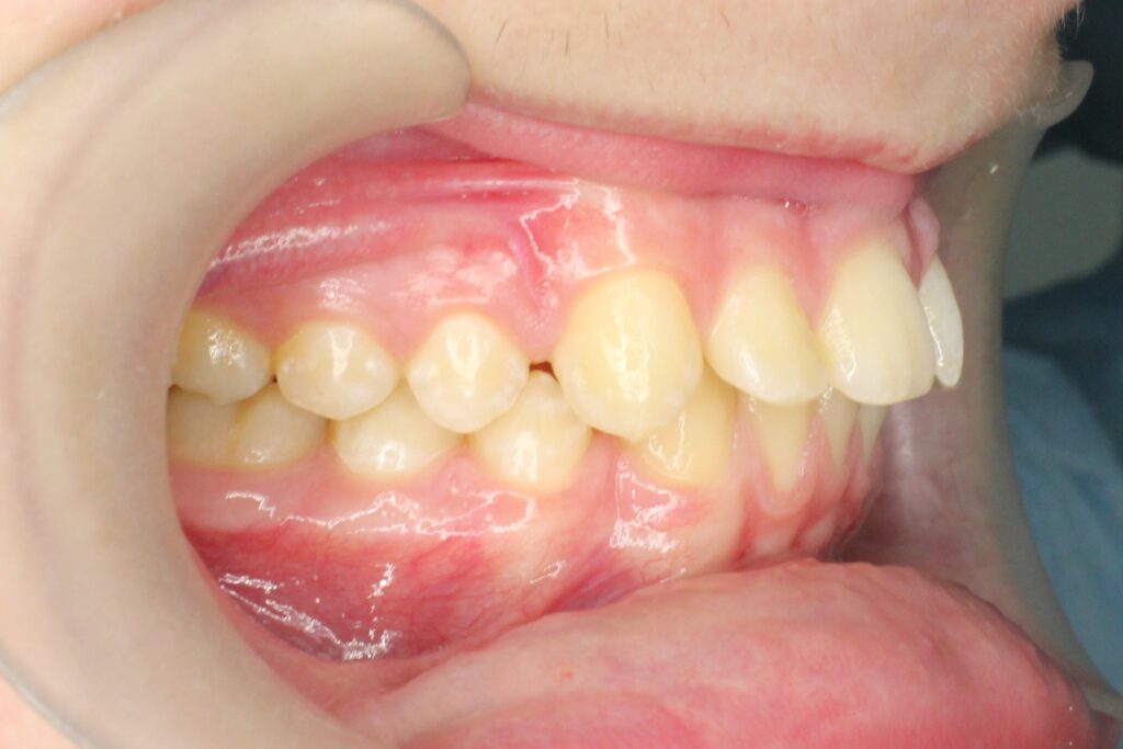 пациент до лечения