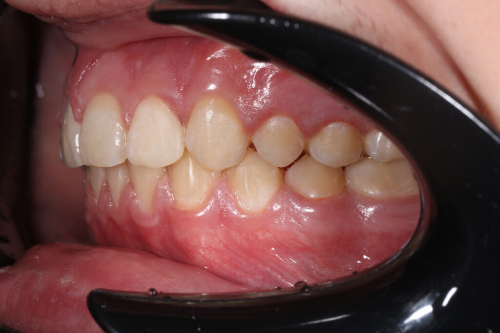 после лечения