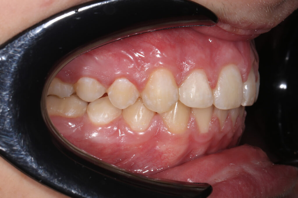 после лечения