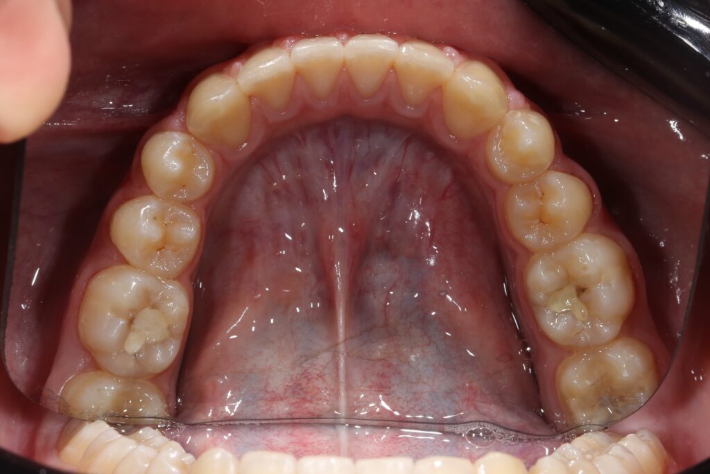 после лечения