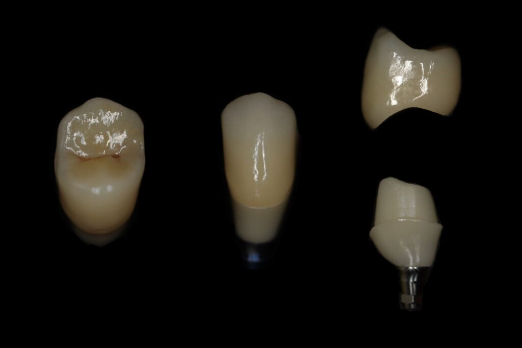 циркониевые протезы Cимпладент