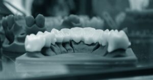 Протезирование