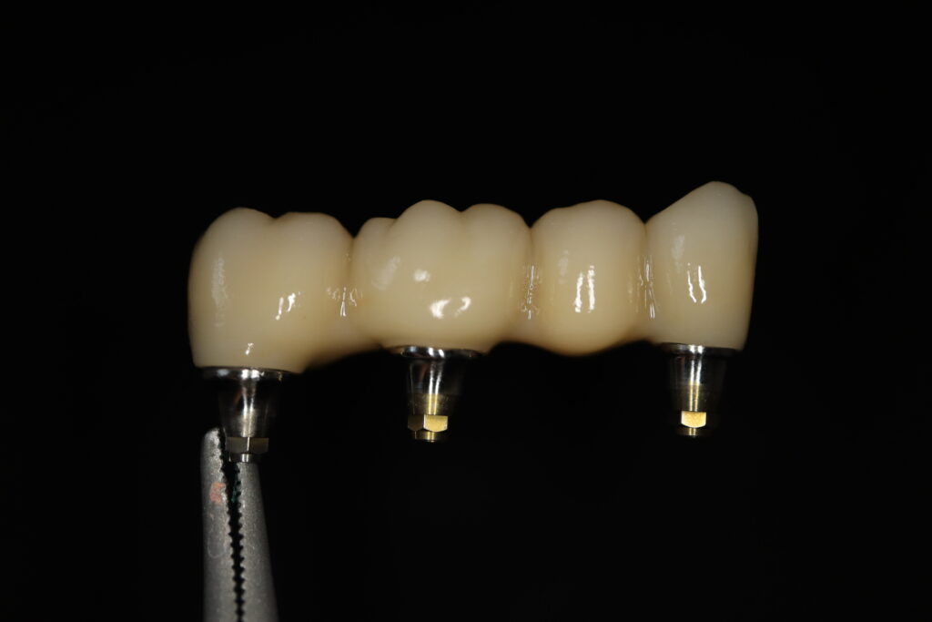 циркониевые протезы Cимпладент