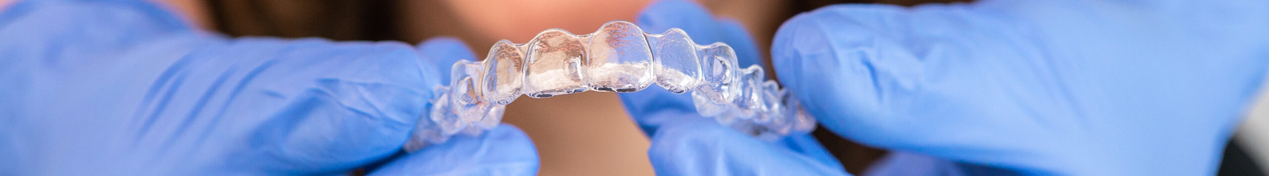 В каких случаях требуется эстетическая реставрация?