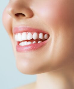 Гингивопластика