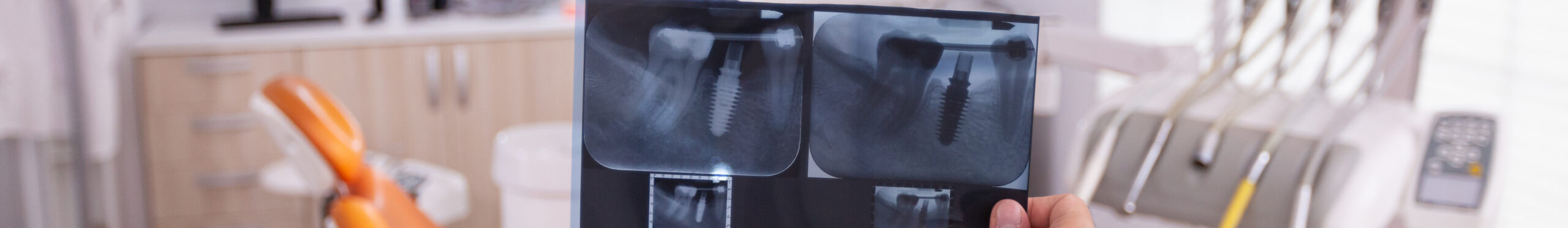 В каких ситуациях могут назначать рентгенодиагностику зубов