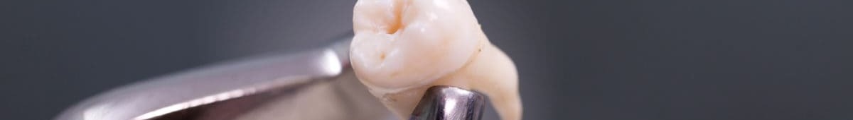 Противопоказания к хирургическим операциям