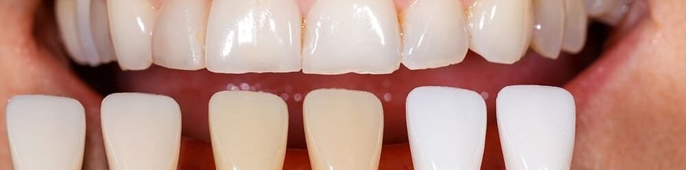 Основные методы проведения профгигиены