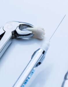 Удаление зубов