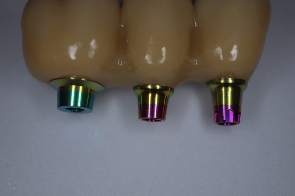 процесс протезирования