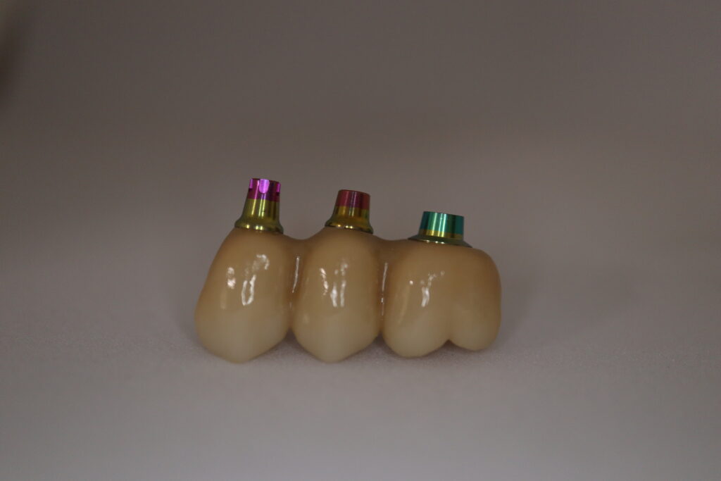 процесс протезирования