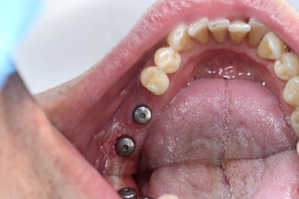 пациент до лечения