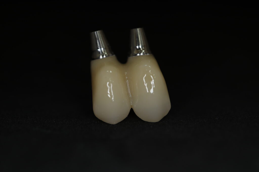 процесс протезирования