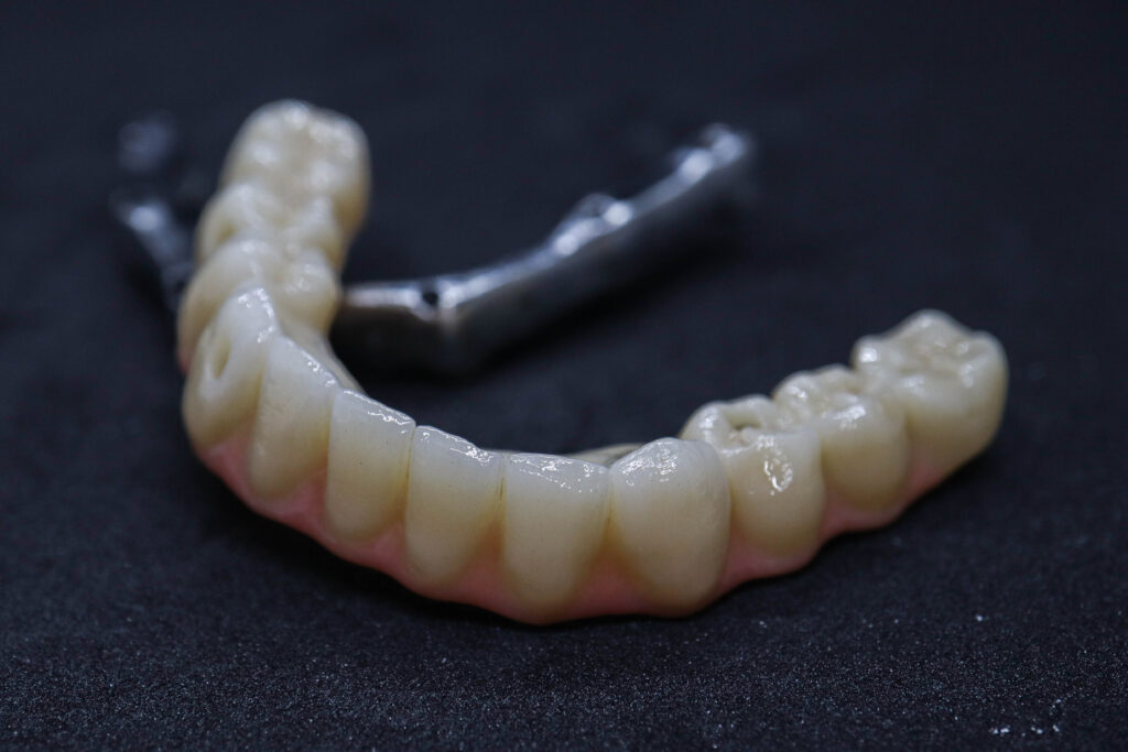 протезы перед установкой