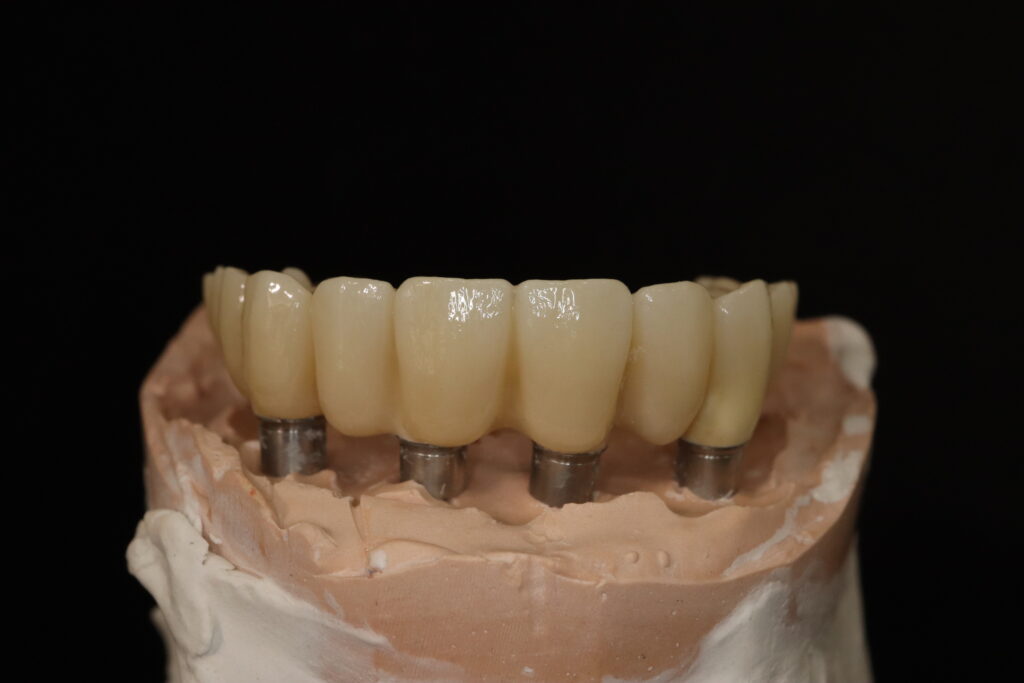 процесс имплантации