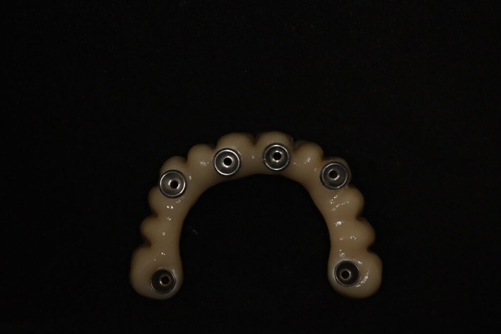 процесс имплантации