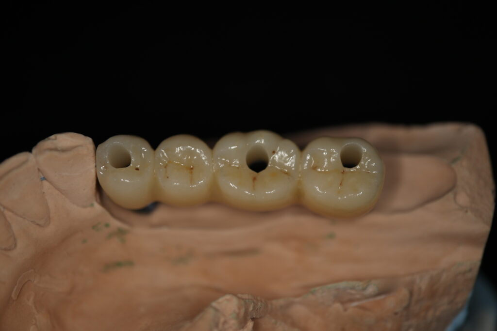 процесс имплантации