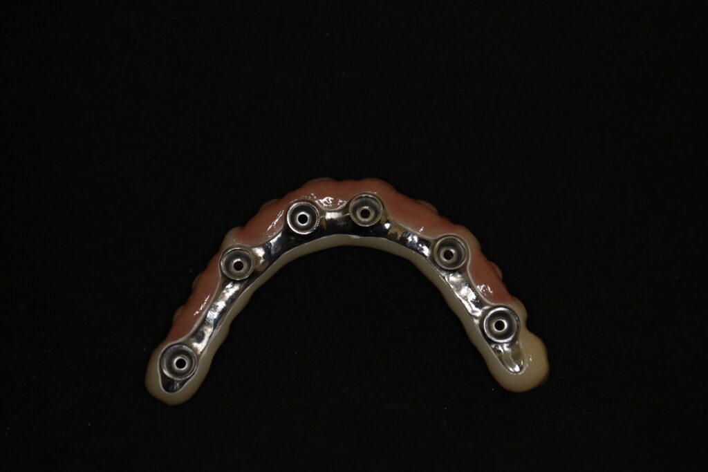 процесс имплантации