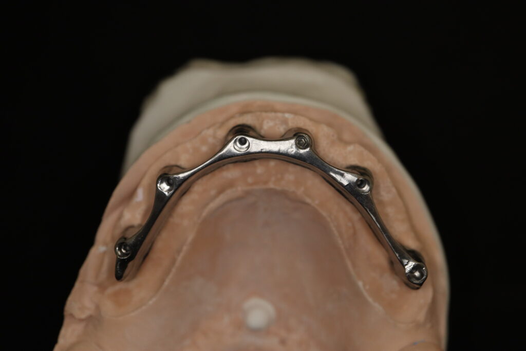 процесс имплантации