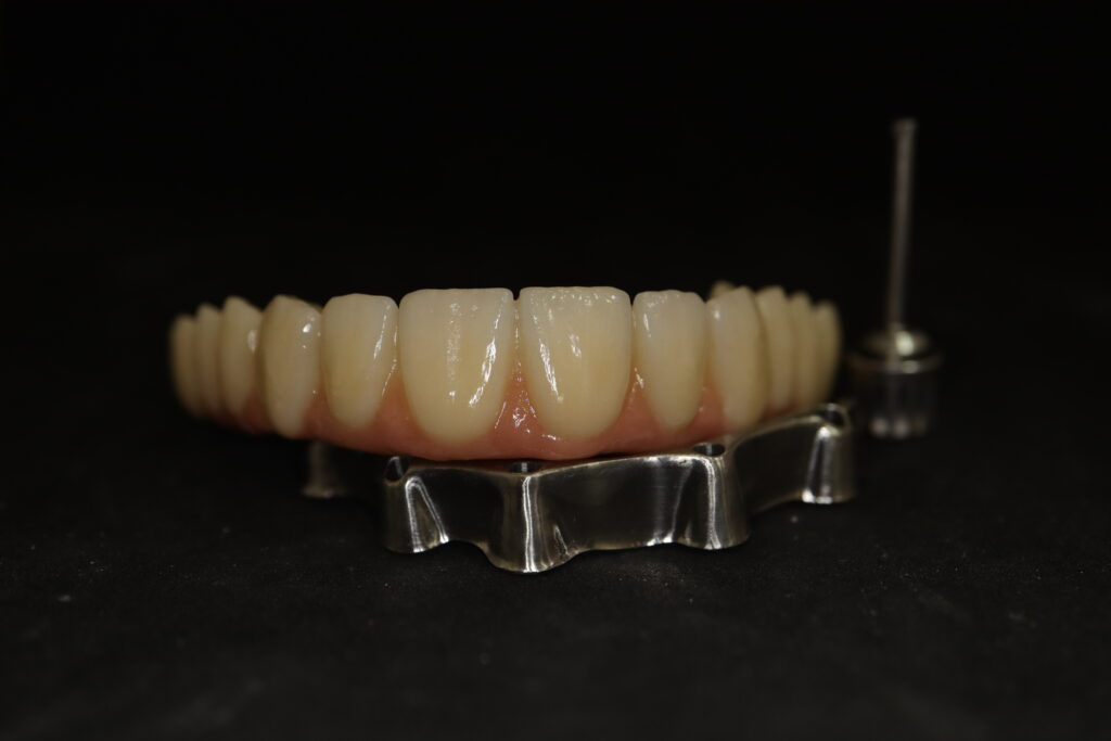 процесс имплантации