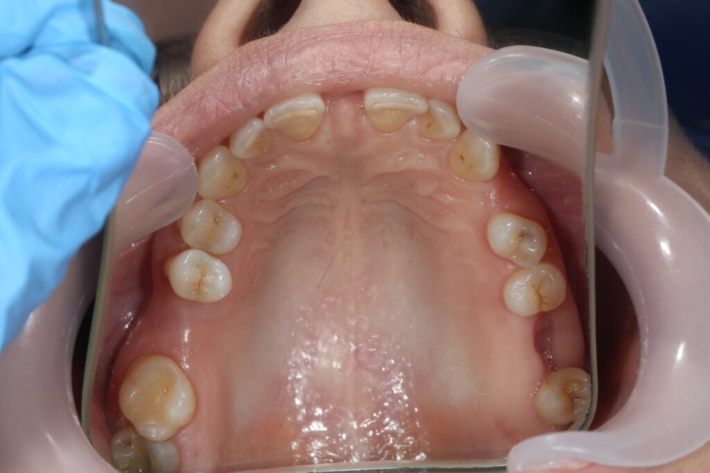 Ситуация до лечения