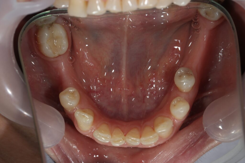 Ситуация до лечения