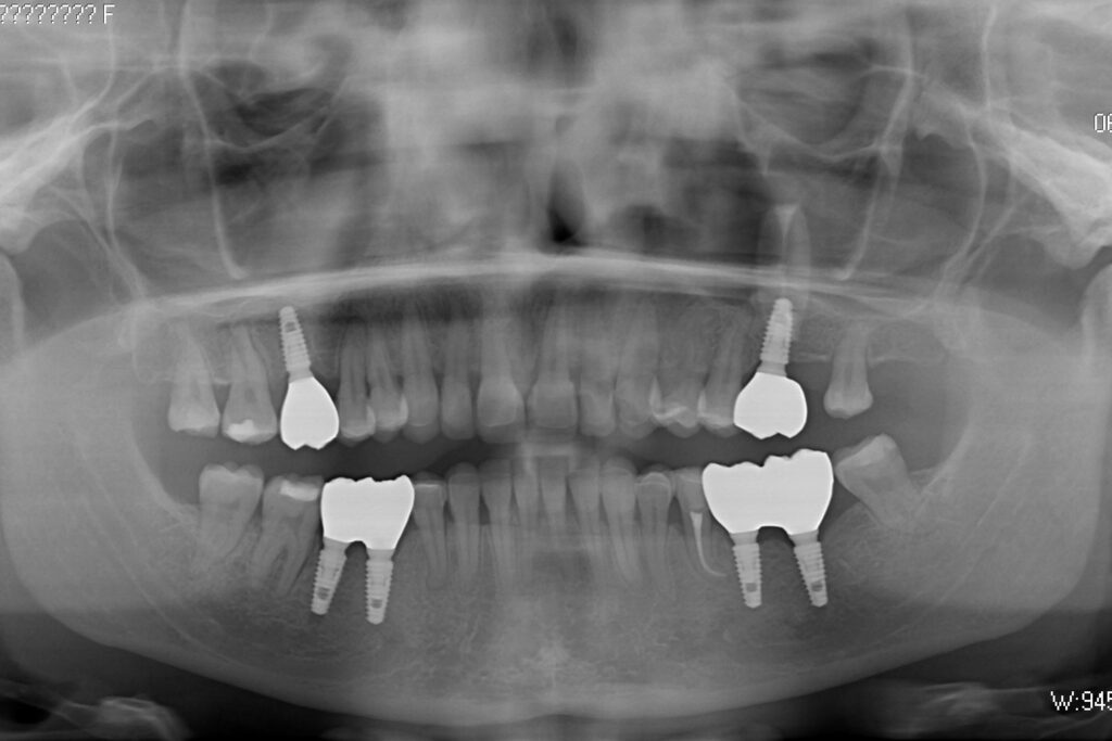 Результаты