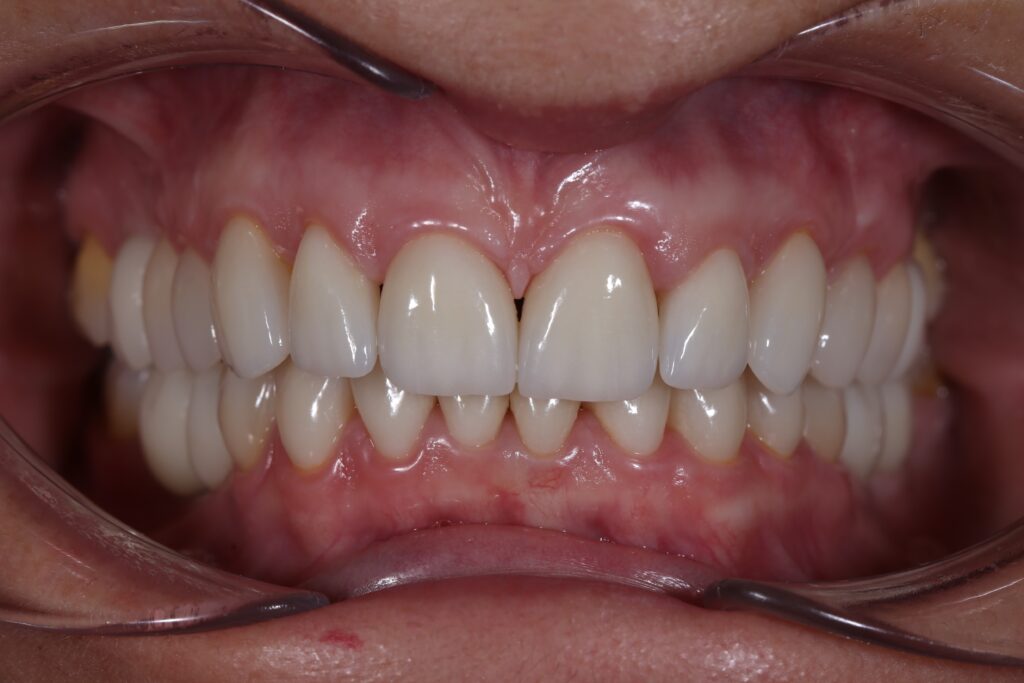 Результаты