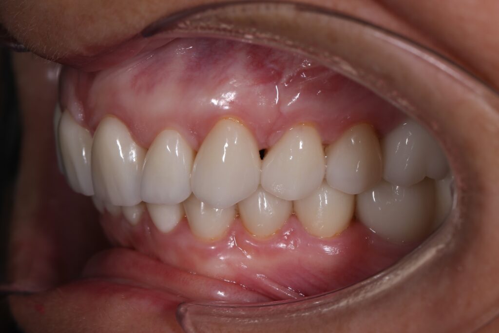 Результаты