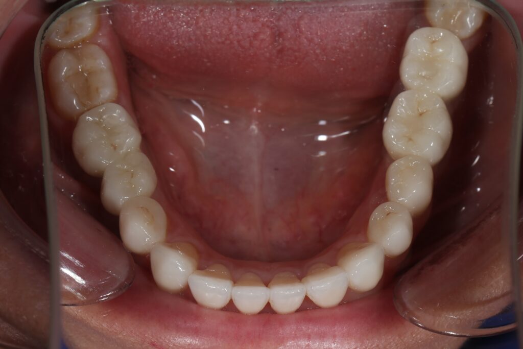 Результаты