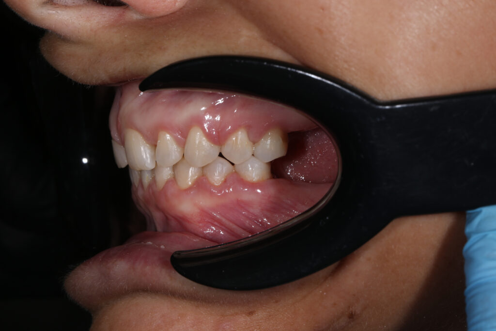 Результаты ортодонтической части