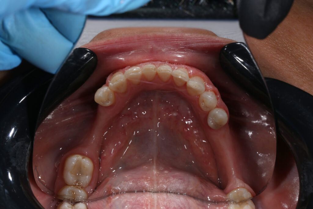 Результаты ортодонтической части